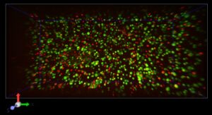 Live (green) and dead (red) cells in a hydrogel observed with confocal microscopy